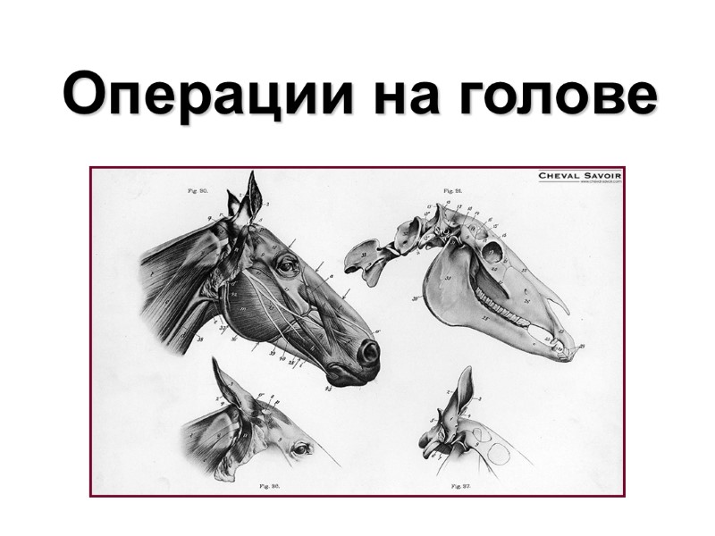 Операции на голове Операции на голове